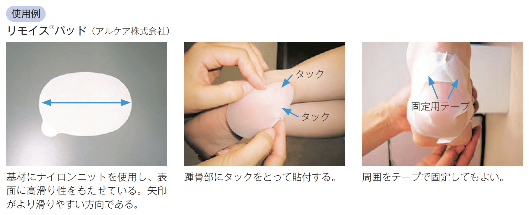 すべり機能付きドレッシング材の貼付