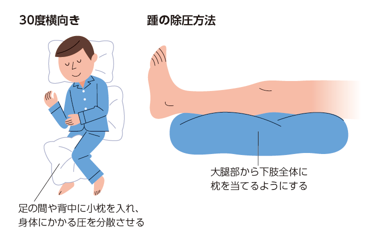 図1 寝ているときの除圧方法